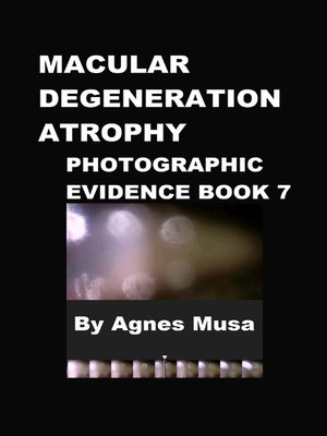 cover image of Macular Degeneration Atrophy, Photographic Evidence Book 7